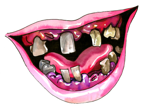 usmev zkazene zuby 2